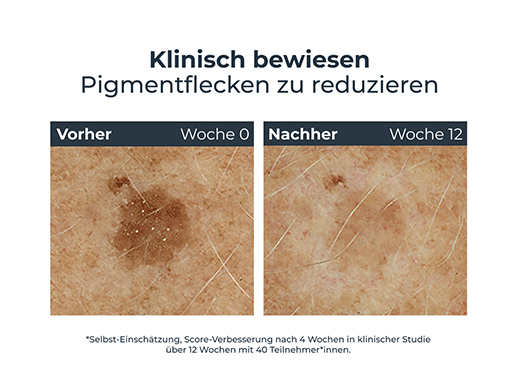 Eucerin